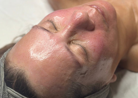 Take Your Facial to the Next Level with Our Treatment Boosts at True Indigo Spa - True Indigo Spa + Wellness