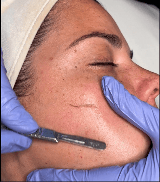 Why a Facial Membership Is the Ultimate Investment in Your Glow - True Indigo Spa + Wellness