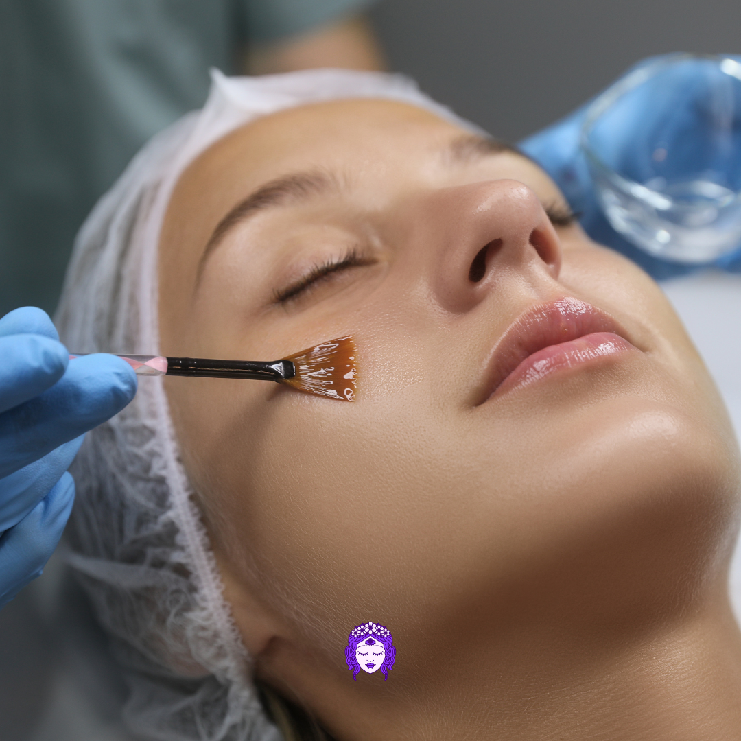 Transform Your Skin with Personalized Facial Peels in Gahanna, Ohio
